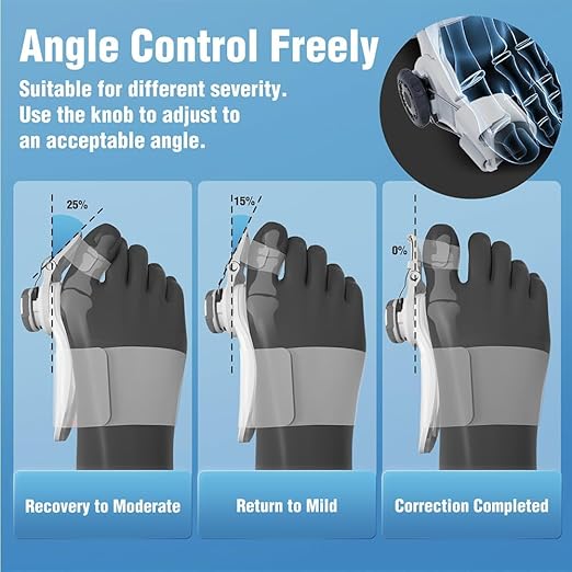 🦶 Corrector Ajustable para Juanetes – Comodidad y Soporte en Cada Paso 🦶