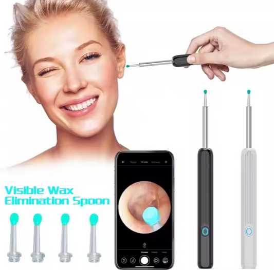 👂Limpiador de Oído HD - ¡Inspección Fácil y Precisa!