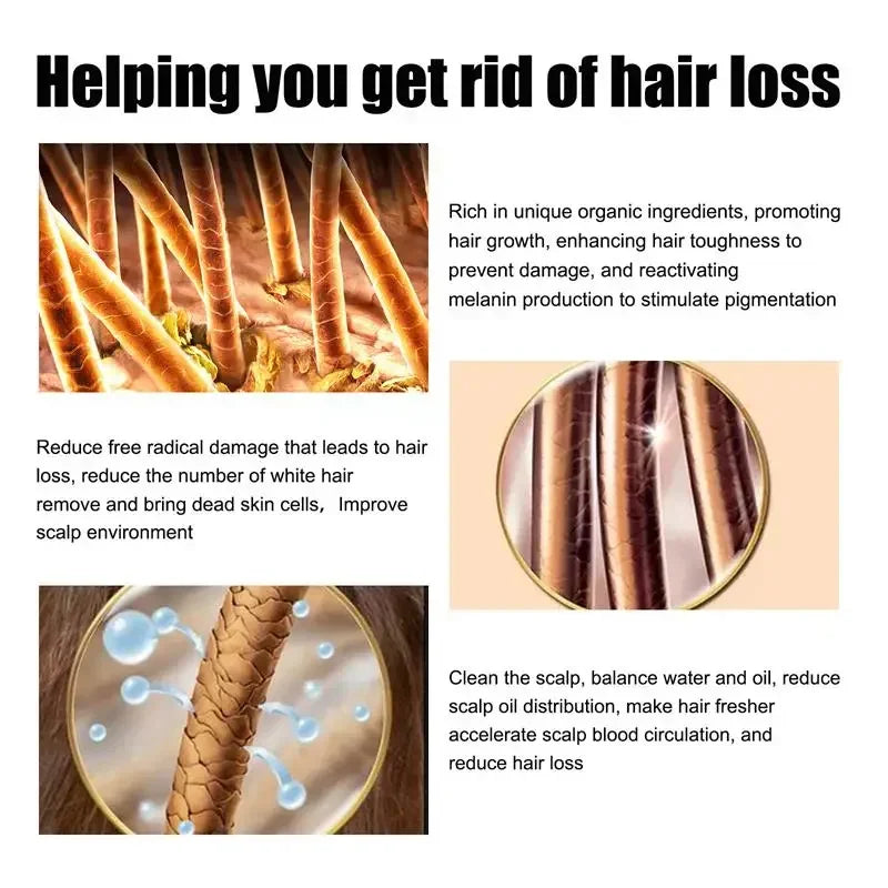 Aceite Crecimiento De Pelo
