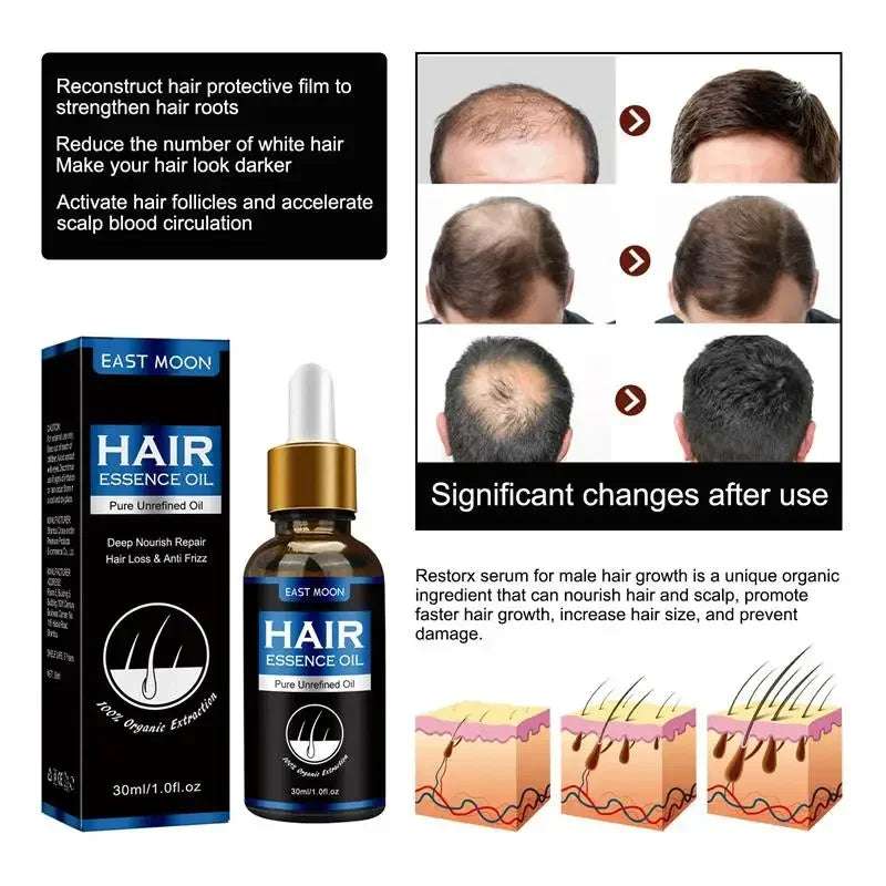 Aceite Crecimiento De Pelo