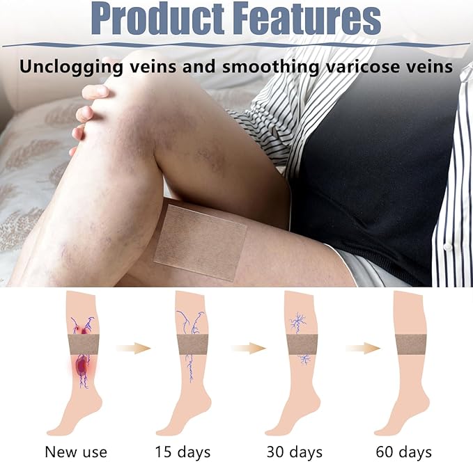 🦵 Parche Alivio Varices – Ligereza y Bienestar para tus Piernas 🦵