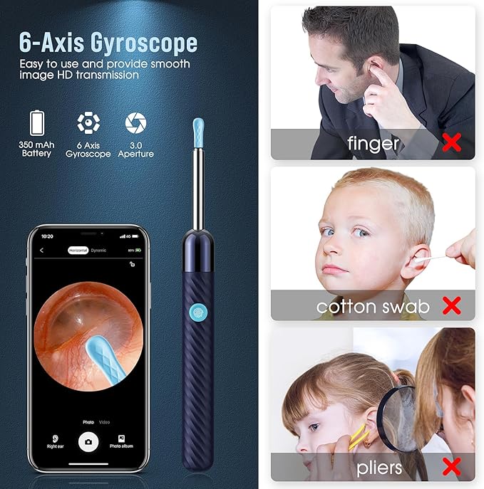 👂Limpiador de Oído HD - ¡Inspección Fácil y Precisa!