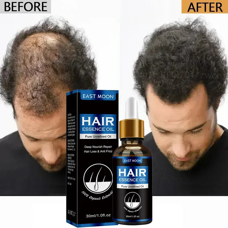 Aceite Crecimiento De Pelo