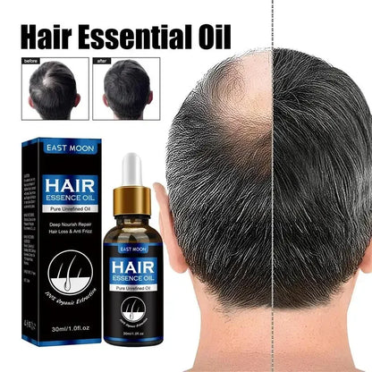 Aceite Crecimiento De Pelo